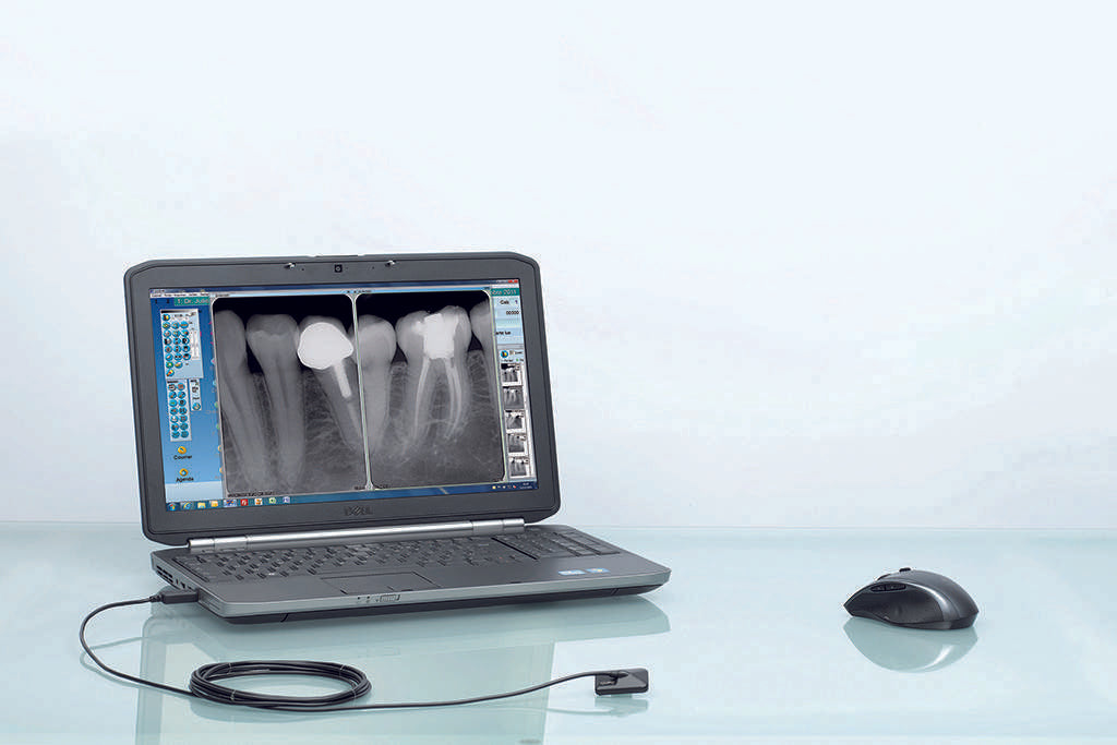 OPTEO Intraoral Sensor