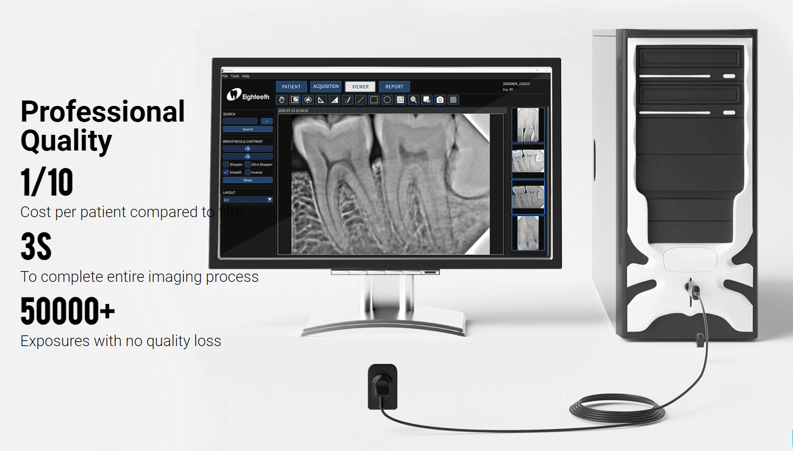 Nanopix Intraoral X-ray Sensor