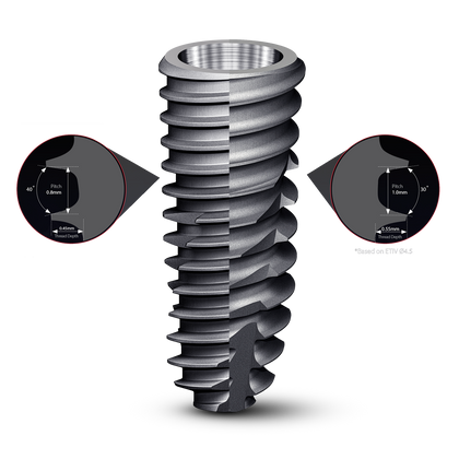 ET Implant System